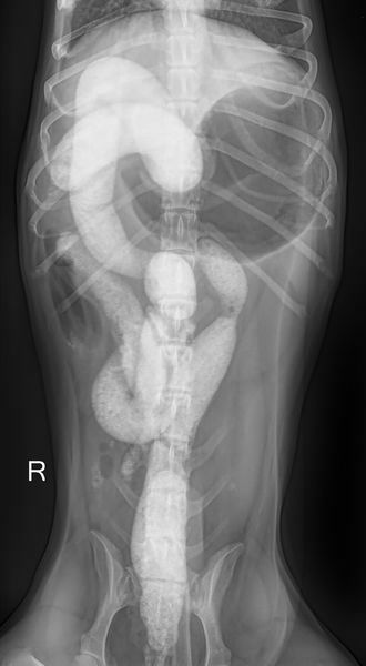 Eine hochgradige Verfüllung von Dick- und Dünndarm zeigt sich auf dieser Röntgenaufnahme, der Magen ist hier zudem gasgefüllt.